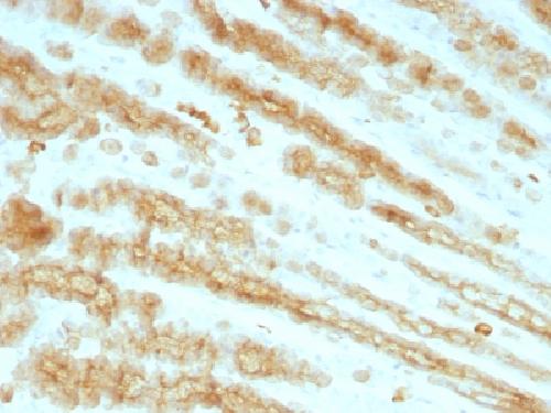 KRT77 Antibody