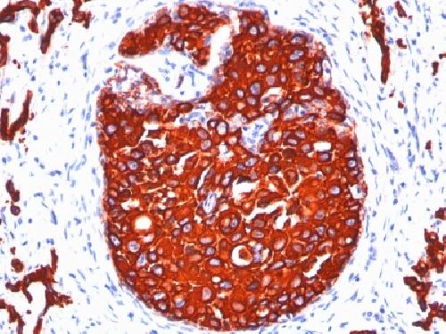 KRT77 Antibody