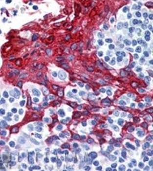 Cytokeratin 13 Monoclonal Antibody