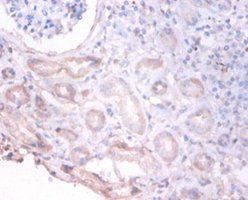 PHGDH Antibody