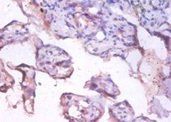 PHGDH Antibody