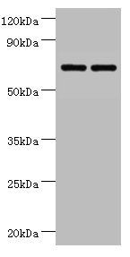 PHGDH Antibody