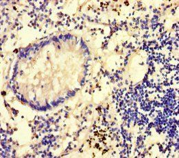 GLCE Antibody