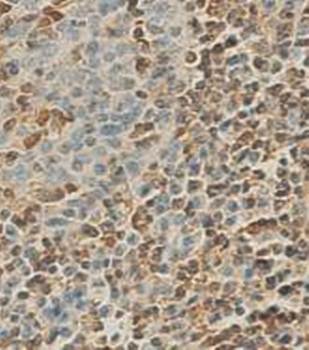 D4 GDI Rabbit Polyclonal Antibody