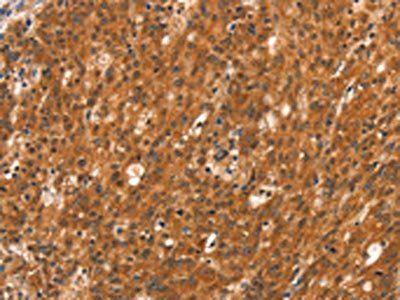DAB2IP Antibody