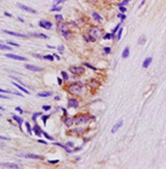 DAB2IP Rabbit Polyclonal Antibody
