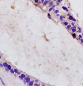 DAB2IP Rabbit Polyclonal Antibody