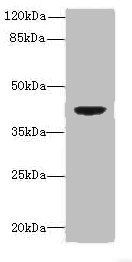 DAPK2 Antibody
