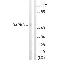 DAPK3 Antibody