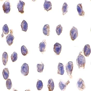 DC-SIGN Monoclonal Antibody