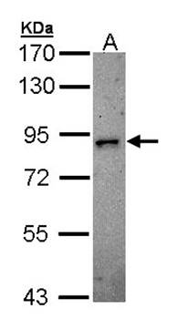 DCAMKL2 Rabbit Polyclonal Antibody