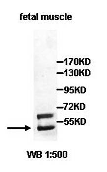 DCDC2 Rabbit Polyclonal Antibody