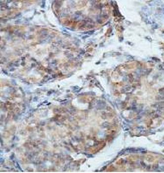 DCDC2 Rabbit Polyclonal Antibody