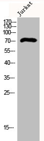 DCLK3 Antibody
