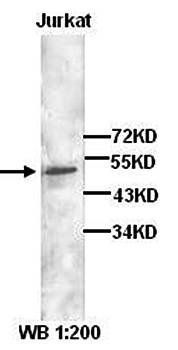 DCP2 Rabbit Polyclonal Antibody