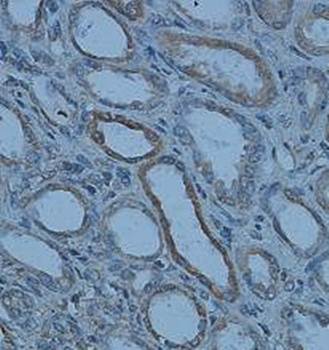 DCP2 Rabbit Polyclonal Antibody