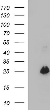DCPS Antibody