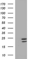DCPS Antibody