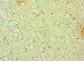DCTN1 Antibody