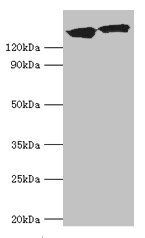 DCTN1 Antibody