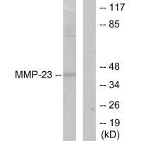 DCTN2 Antibody