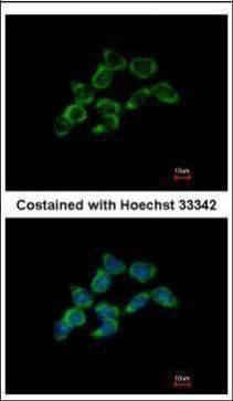 DDAH1 Rabbit Polyclonal Antibody