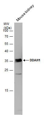 DDAH1 Rabbit Polyclonal Antibody