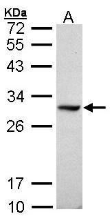 DDAH1 Rabbit Polyclonal Antibody