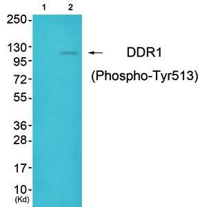 DDR1 (Phospho-Tyr513) Antibody