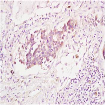 CD167b/DDR2 Rabbit Polyclonal Antibody