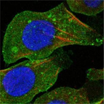DDR2 Mouse Monoclonal Antibody