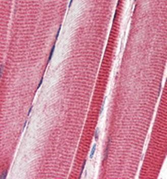 DDR2 Mouse Monoclonal Antibody