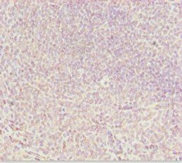 DDX11 Antibody