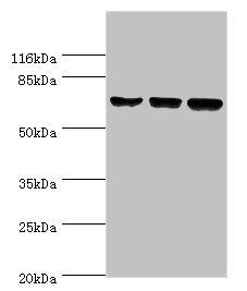 DDX3X Antibody