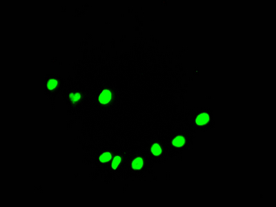 DDX5 Antibody