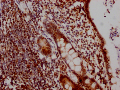 DDX5 Antibody