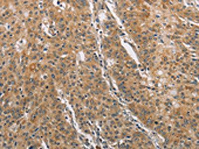 DDX53 Antibody