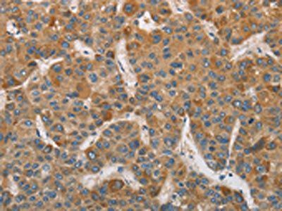 DDX53 Antibody
