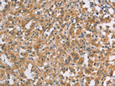 DDX53 Antibody