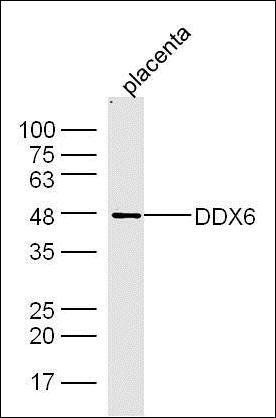 DDX6 Rabbit Polyclonal Antibody