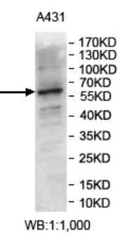 CYP24A1 Rabbit Polyclonal Antibody
