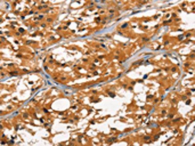 DEFA1/DEFA3 Antibody