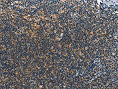 DEFA1/DEFA3 Antibody