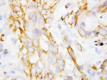 beta Defensin 1/DEFB1 Rabbit Polyclonal Antibody