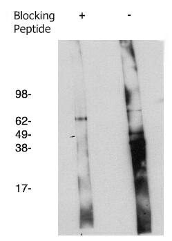 Rabbit Human Degenerative Spermatocyte Homolog 2 (DEGS2) Antibody