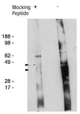 Rabbit Human Degenerative Spermatocyte Homolog 2 Antibody