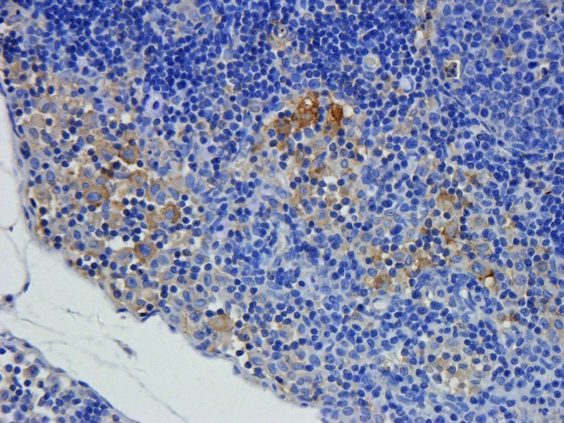 DEPDC1 Rabbit Polyclonal Antibody