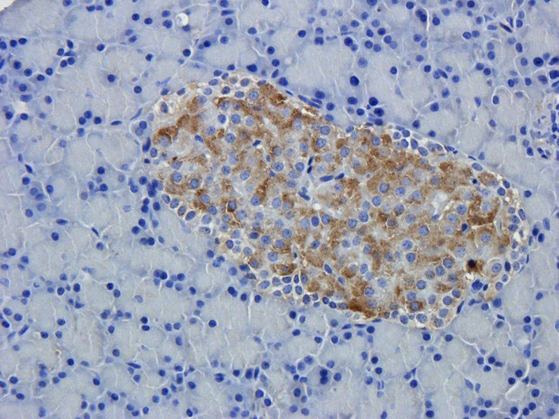DEPDC1 Rabbit Polyclonal Antibody