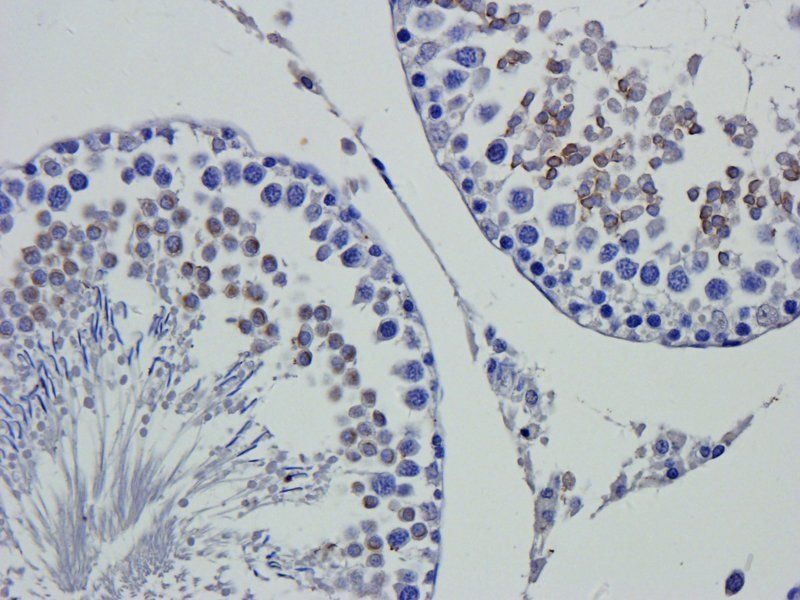 DEPDC1 Rabbit Polyclonal Antibody
