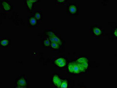 DES Antibody